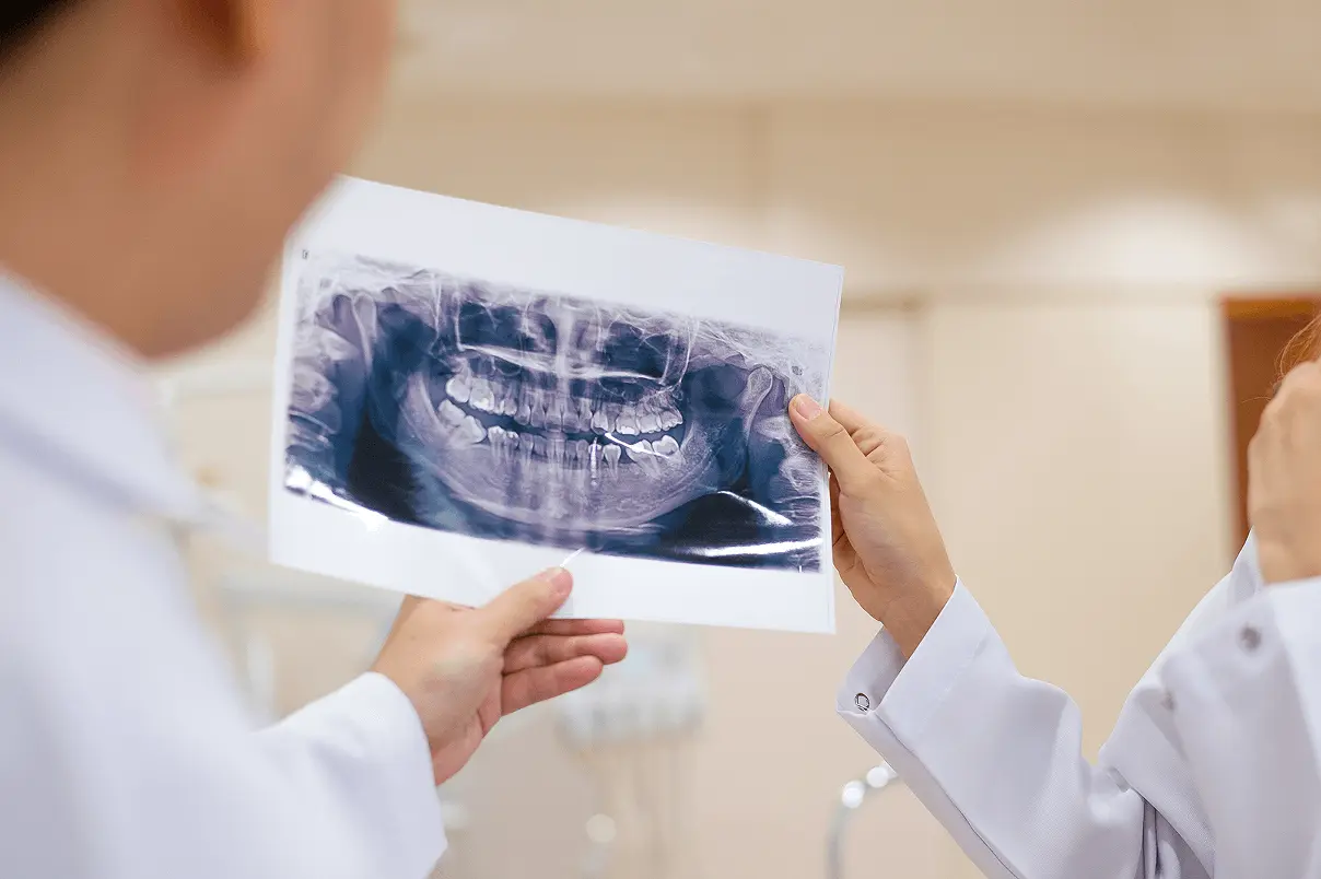 Vista da sopra le spalle di due dentisti in camice bianco che analizzano insieme una radiografia panoramica (ortopantomografia) delle arcate dentarie.