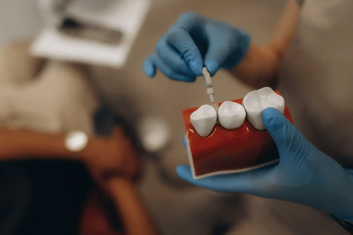 Mani di un igienista dentale con guanti azzurri che mostra come inserire lo scovolino tra due denti su un modello didattico.