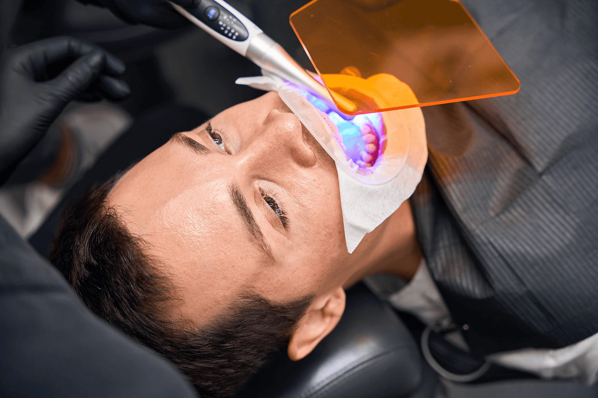 Vista dall'alto di un paziente steso sulla poltrona mentre il dentista utilizza una lampada a luce polimerizzante blu proteggendo gli occhi con uno schermo arancione.