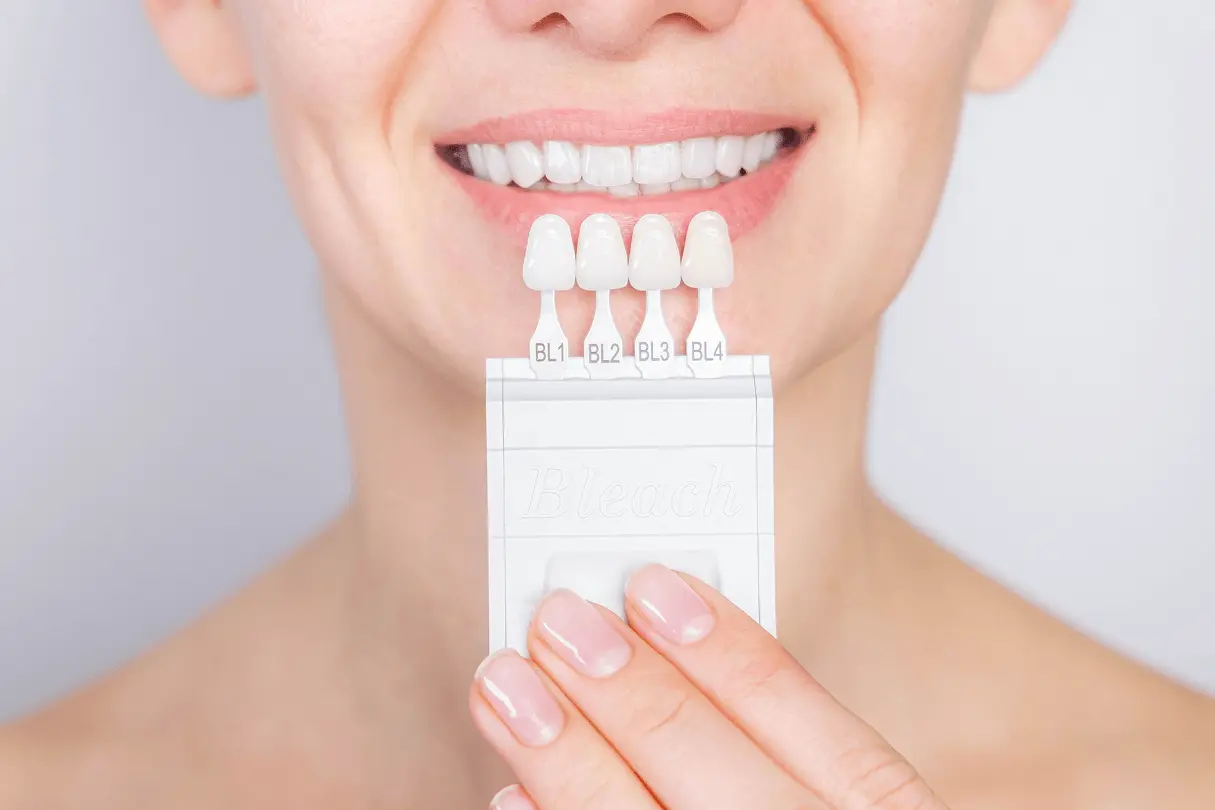 Primo piano del sorriso di una donna con denti bianchi affiancato da una guida di campioni di colore "Bleach" da BL1 a BL4.