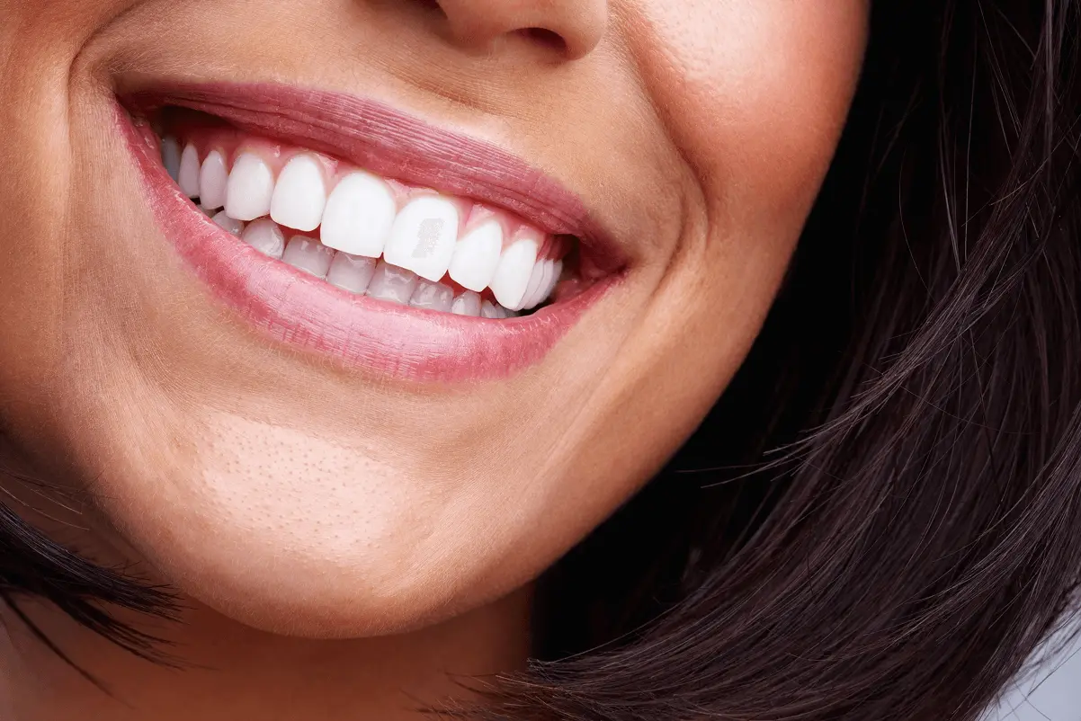 Macro e dettaglio in primo piano del sorriso di una donna con denti bianchi, curati e perfettamente allineati.