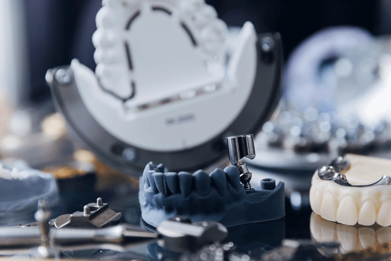 Dettaglio di modelli di arcate dentarie, moncone implantare in titanio e articolatore sullo sfondo all'interno di un laboratorio odontotecnico.