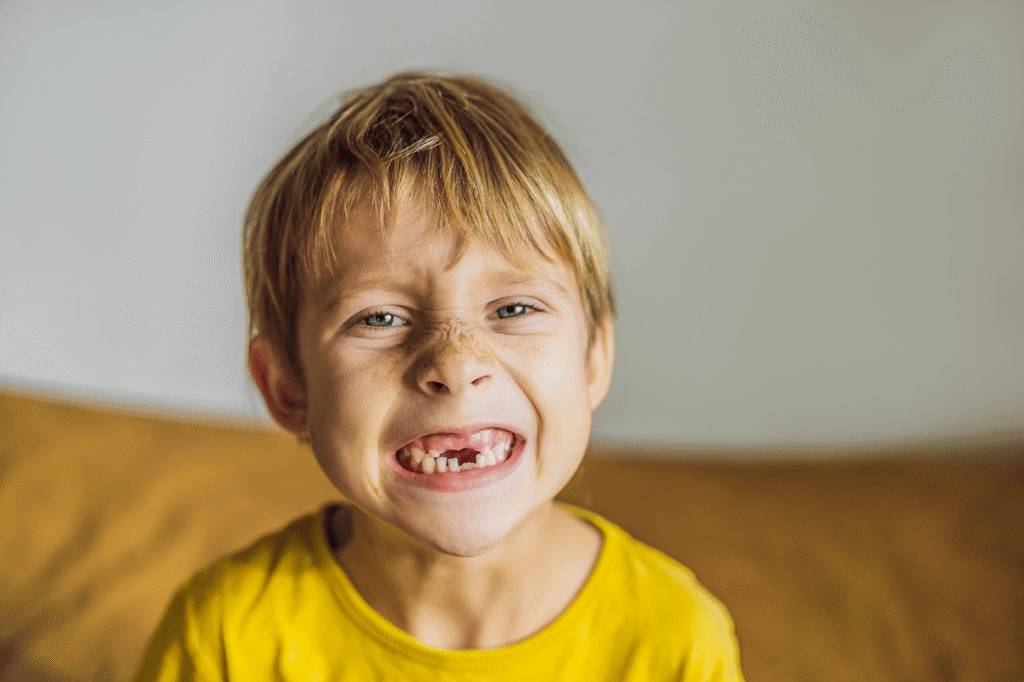 Primo piano di un bambino biondo con maglietta gialla che fa una smorfia sorridente mostrando la finestra lasciata dalla caduta di un dente da latte.