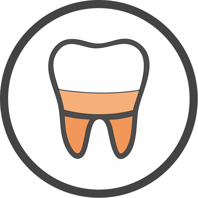 Icona stilizzata di un dente con una corona protesica posizionata sulla struttura radicolare.