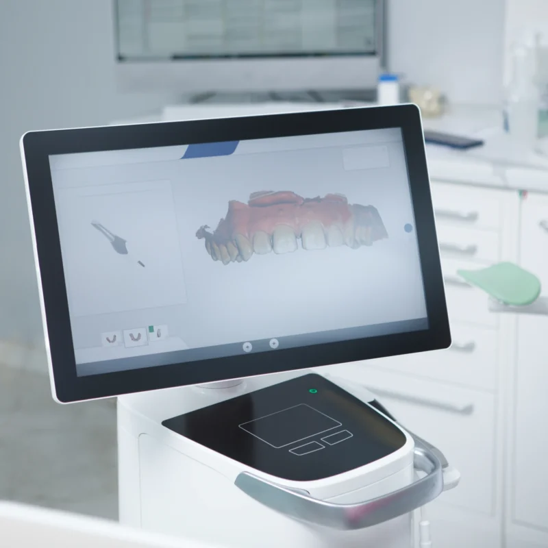 Monitor di uno scanner intraorale che mostra il modello 3D a colori dell'arcata dentale superiore del paziente.