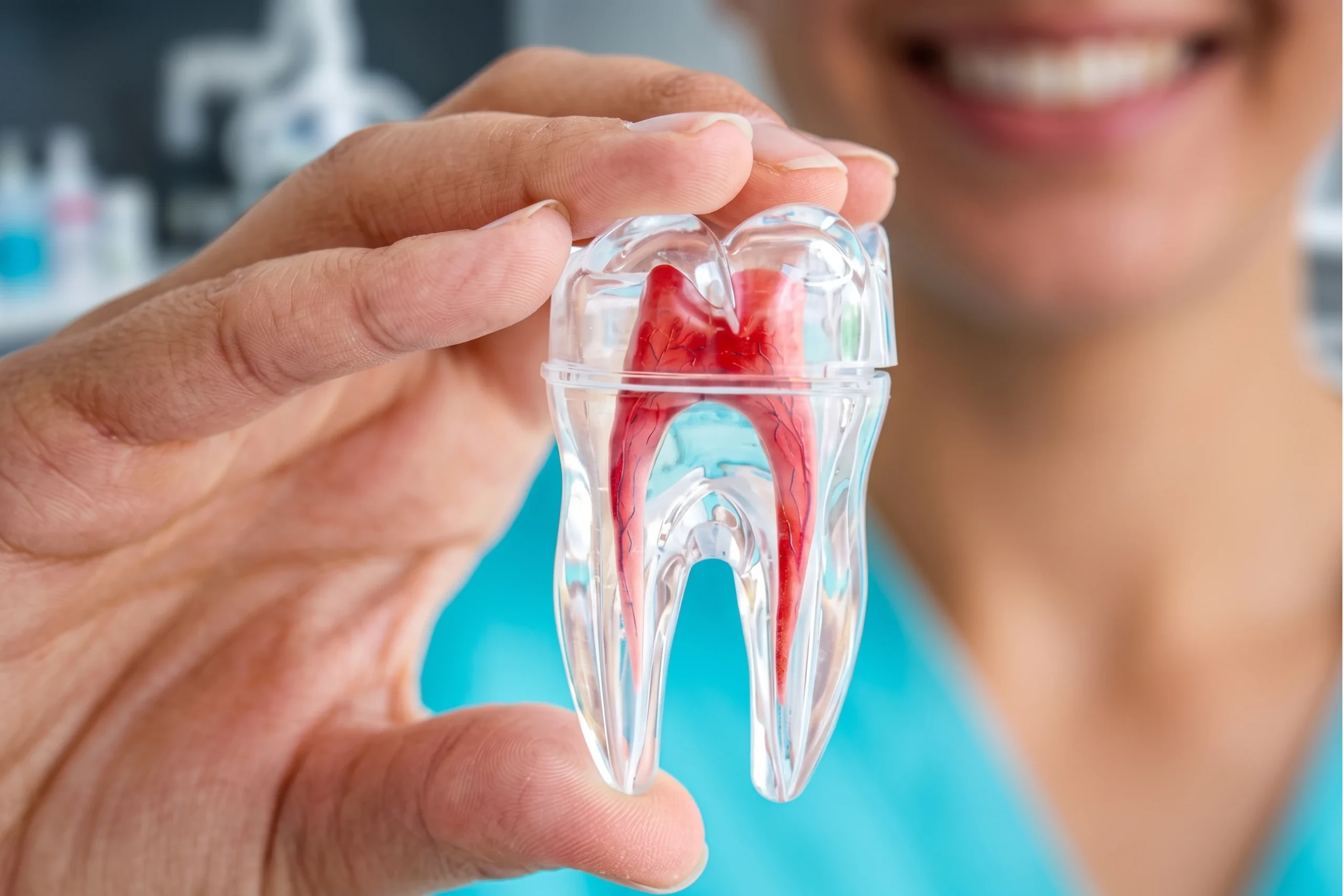 Mano di una dentista che tiene un modello trasparente di un dente molare, mostrandone la polpa rossa interna e i canali radicolari.